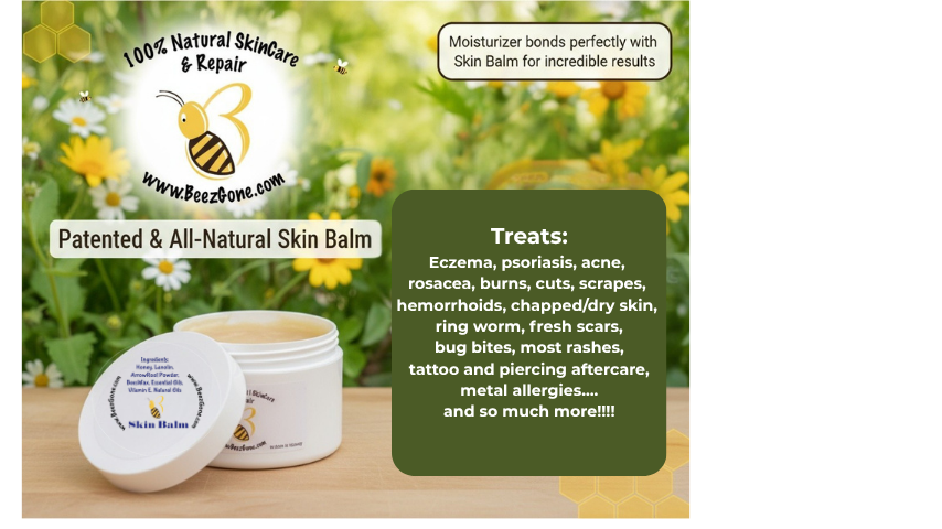 Beez Gone Skin Balm – Patent-Protected Purity