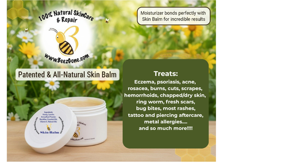 Beez Gone Skin Balm – Patent-Protected Purity